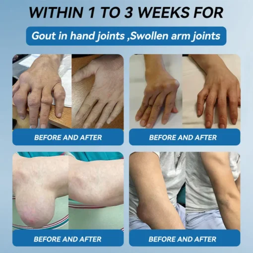 Tnnedey® BPC-157 Joint Healing Cream