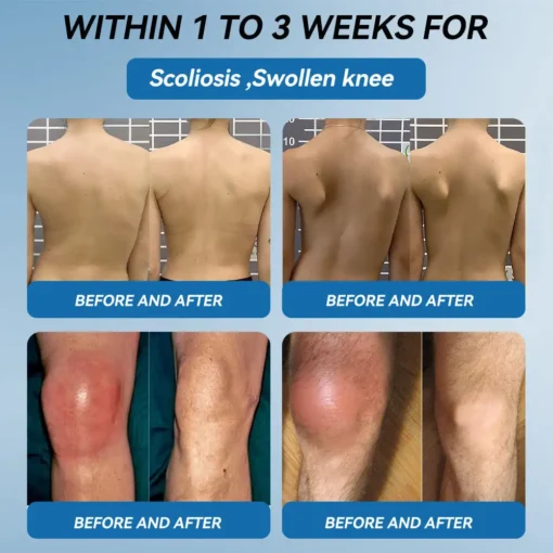 Tnnedey® BPC-157 Joint Healing Cream