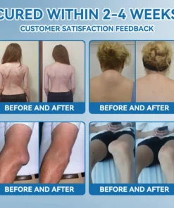 Tnnedey® BPC-157 Joint Healing Cream