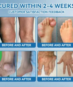 Tnnedey® BPC-157 Joint Healing Cream