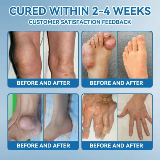 Tnnedey® BPC-157 Joint Healing Cream