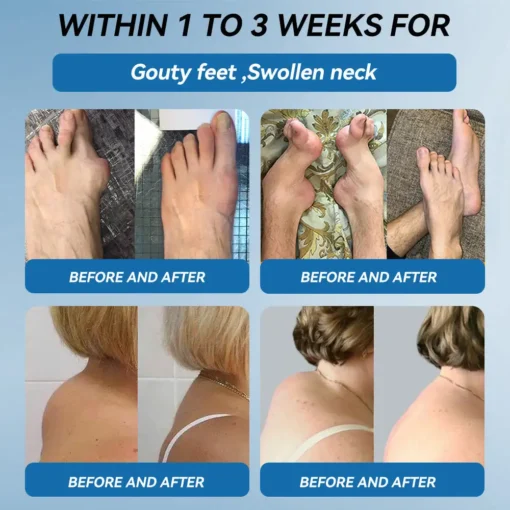 Tnnedey® BPC-157 Joint Healing Cream