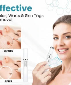 Tnnedey®Non-Invasive Skin Imperfection Removal Pen