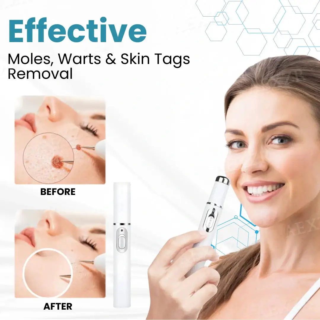 Tnnedey®Non-Invasive Skin Imperfection Removal Pen