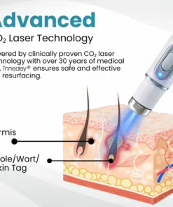 Tnnedey®Non-Invasive Skin Imperfection Removal Pen