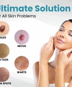 Tnnedey®Non-Invasive Skin Imperfection Removal Pen